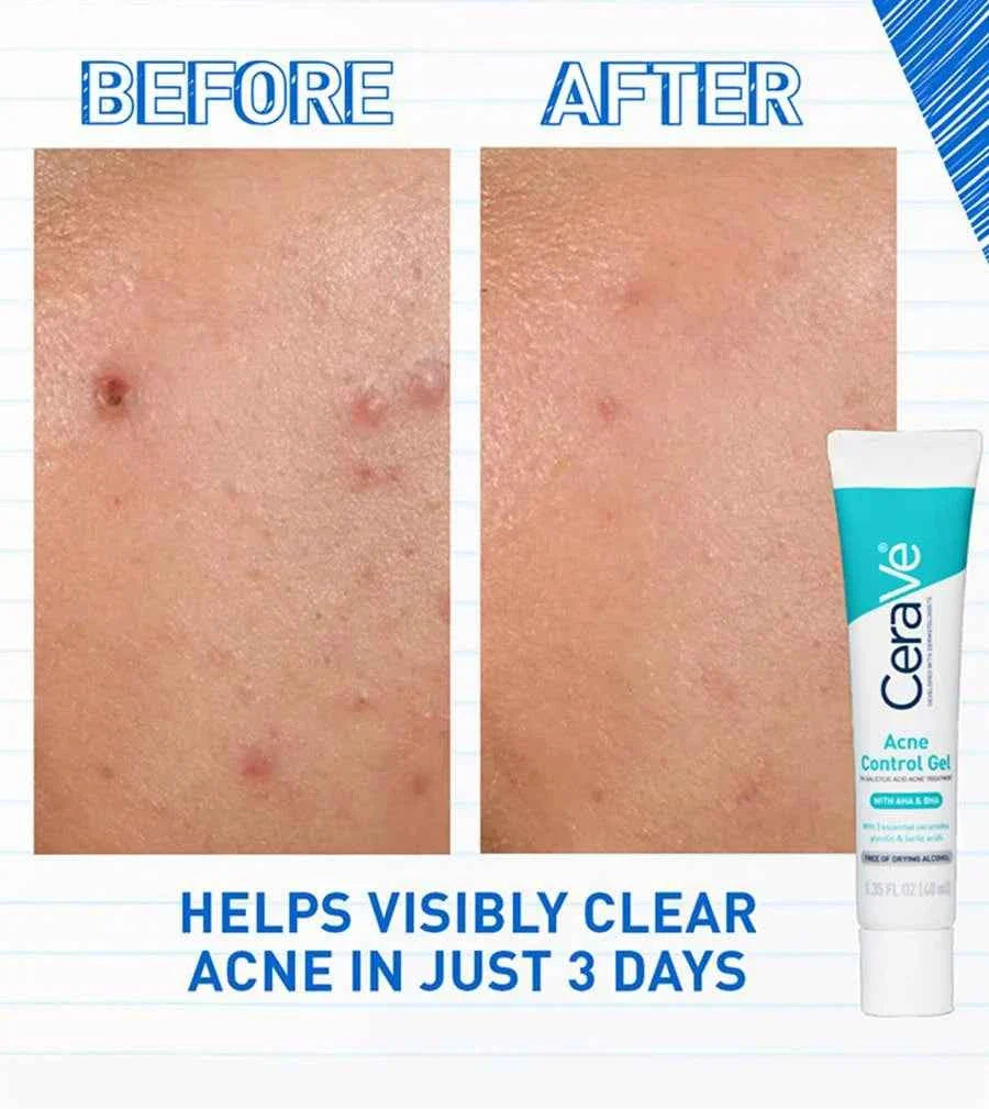cerave Acne Control Gel 40ml